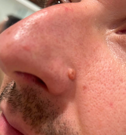 Peel Shot Glow Ampoule Duo