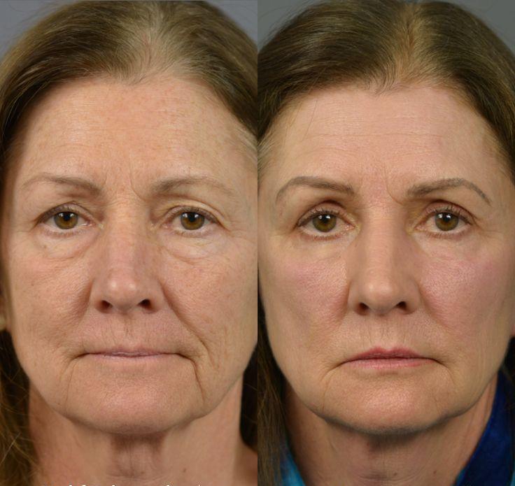 🌸 Youthful Perfection™ Eye Primer & Tightener ✨