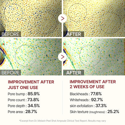 Peel Shot Glow Ampoule Duo